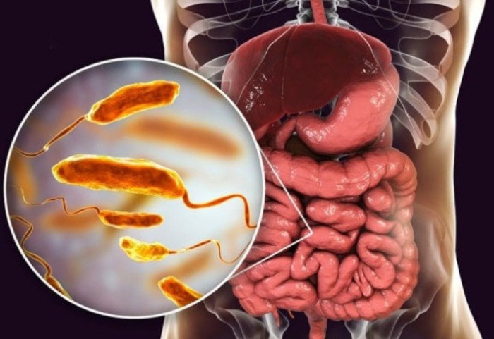 Alarm nga vdekja e pensionistit, kolera rikthehet në Britani pas 125 vitesh