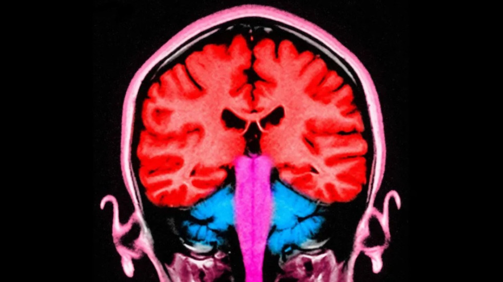 A mund të na bëjë më pak egoistë një puls elektriciteti në tru?