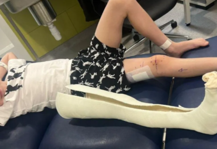 9-vjeçari në Britani i nënshtrohet operacionit për zgjatjen e këmbëve