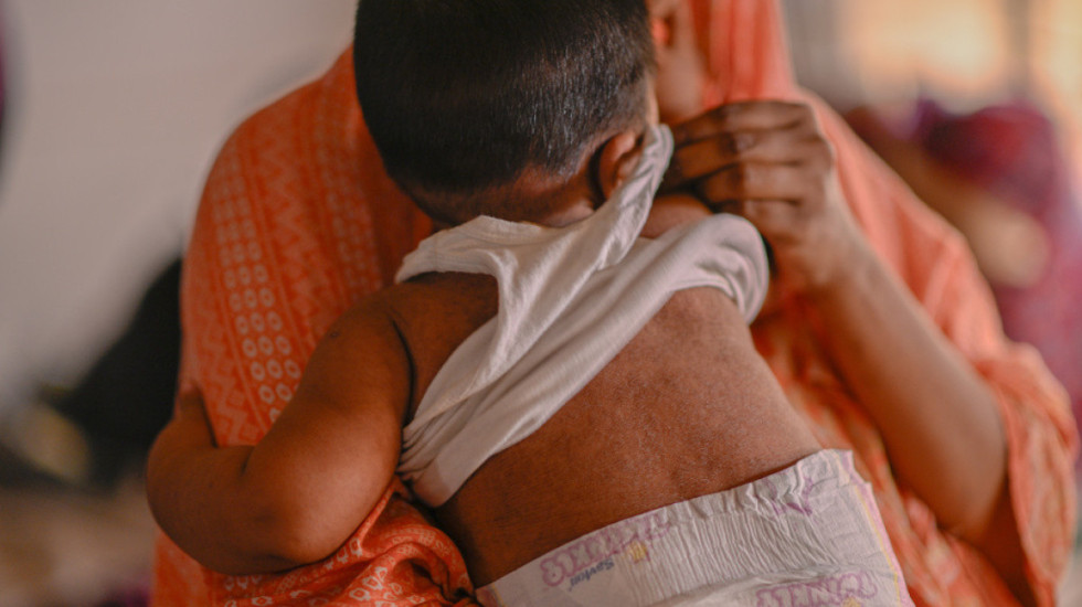 Prag epidemie, mbi 100 viktima nga fruthi në Bangladesh